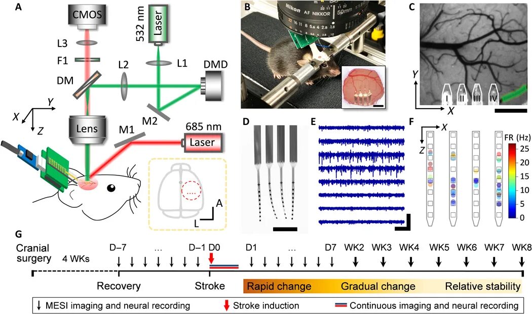 Brain 291. Electrode array for Neural interfaces flexible Composite. Meiji Optic Path scheme. Schema of autoregulation of CBF in stroke.