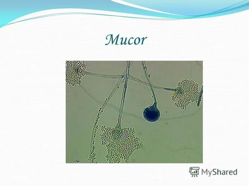 Разрушить клетку гриба. Разрушить клетку гриба. Грибы вызывающие заболевания. Строение грибной клетки микробиология. Разрушить клетку гриба.