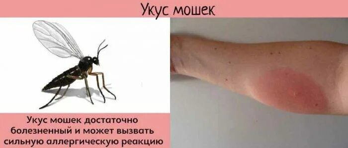 Почему чешется комариный