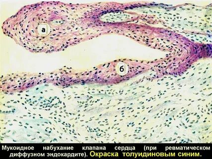 Мукоидное набухание это