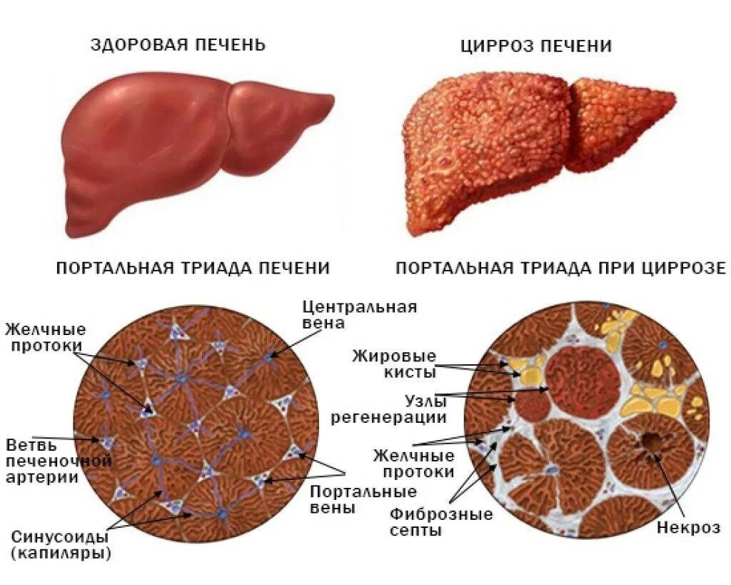 Кровь в печени причины