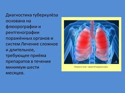 Туберкулез презентация
