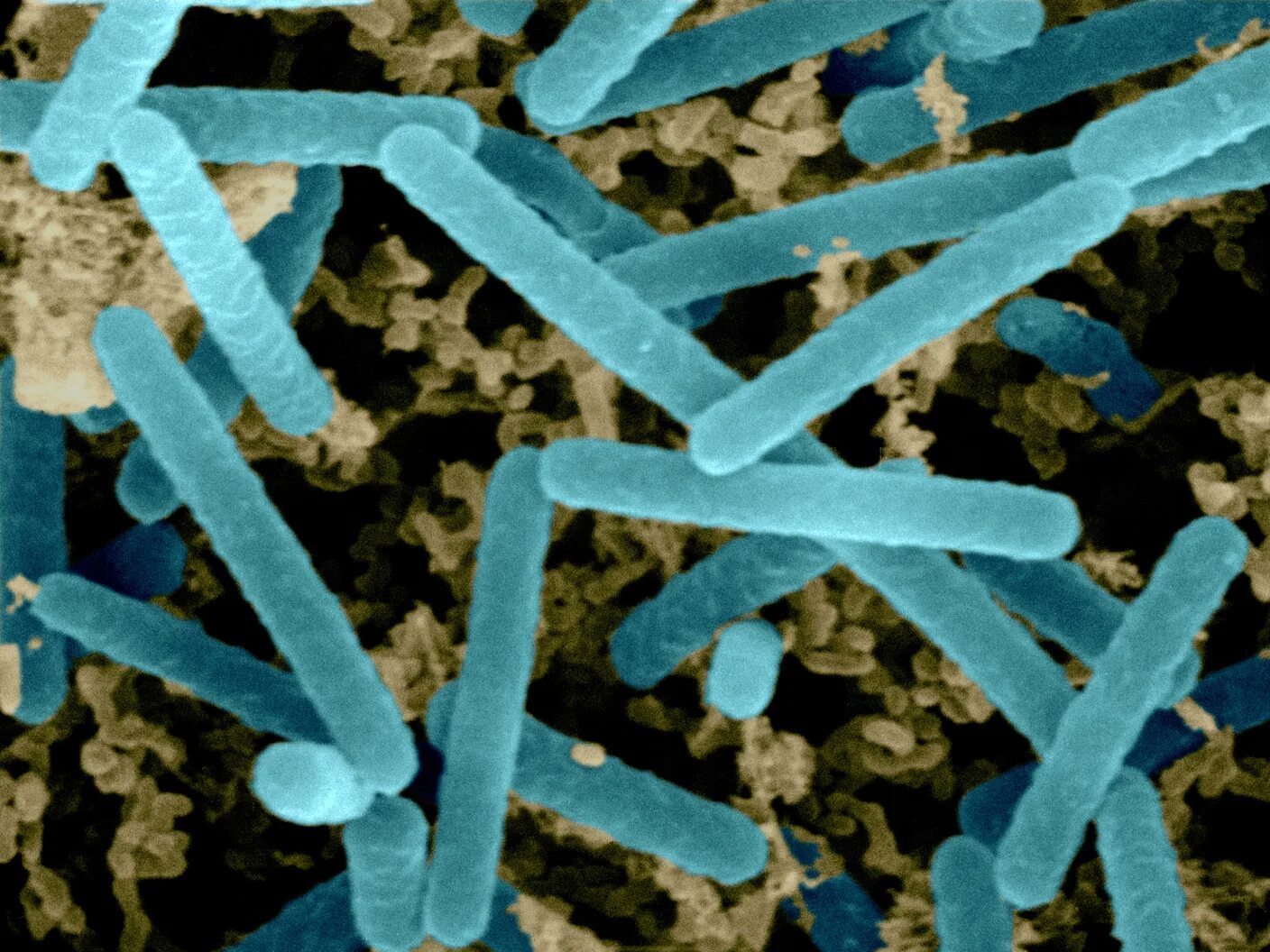 Палочка бифидобактерии. Ацидофильные лактобактерии (Lactobacillus Acidophilus). Lactobacillus Acidophilus (ацидофильная палочка). Lactobacillus Acidophilus в микроскопе. Молочнокислые бактерии (Lactobacillus plantarum).