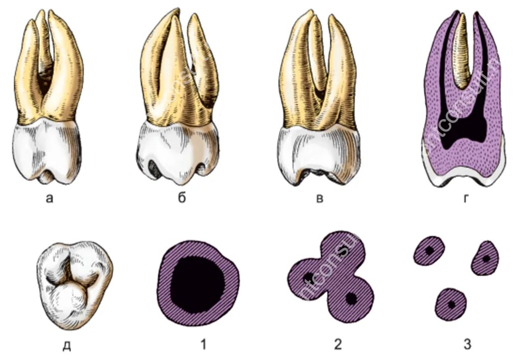 Первый моляр верхней челюсти. 3 Моляр верхней челюсти анатомия. Третий верхний моляр анатомия. 3 Моляр нижней челюсти анатомия.