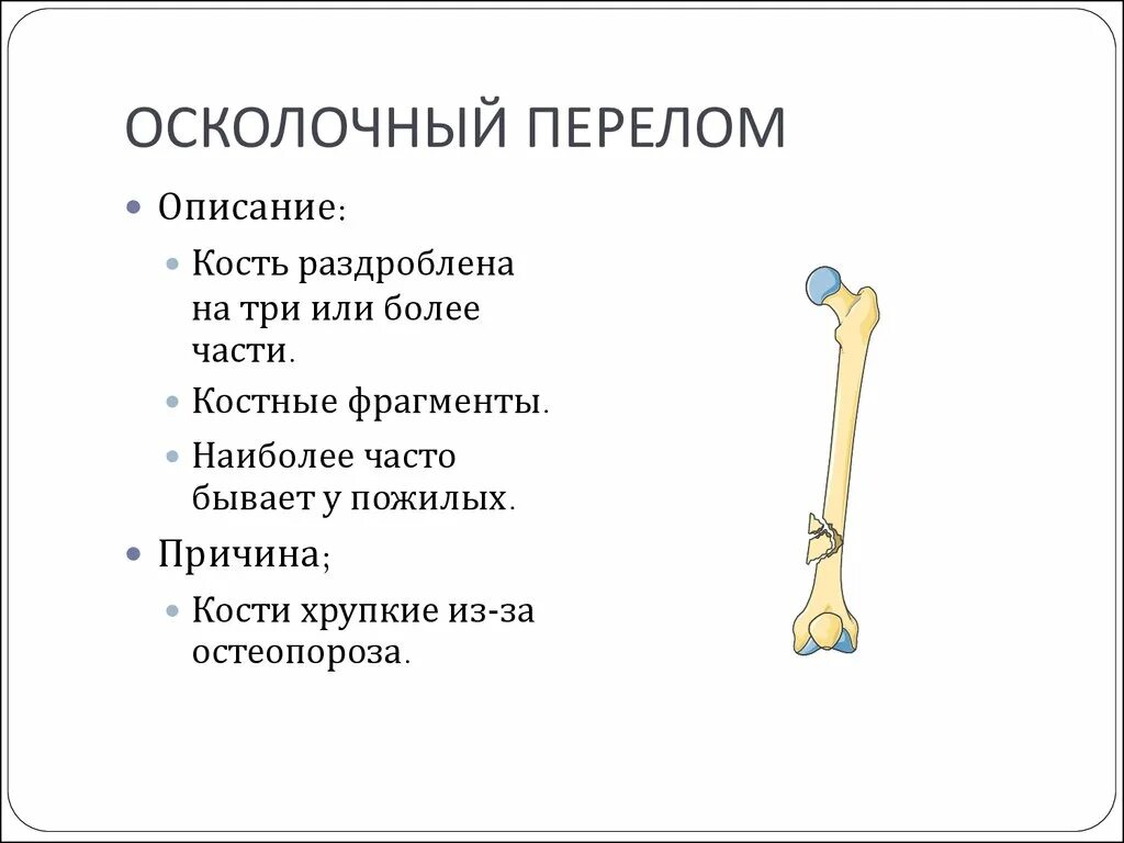 Почему кости легкие. Какие виды переломов вы знаете.