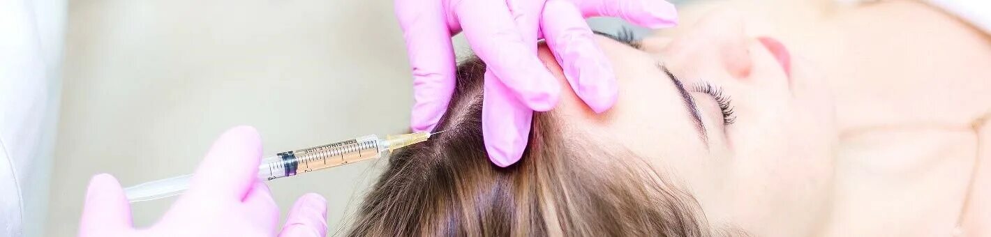Инъекции головы. Мезотерапия волосистой части головы. Микротоковая терапия волосистой части головы. Биорепарация кожи головы волос. Уколы в кожу головы для роста волос.
