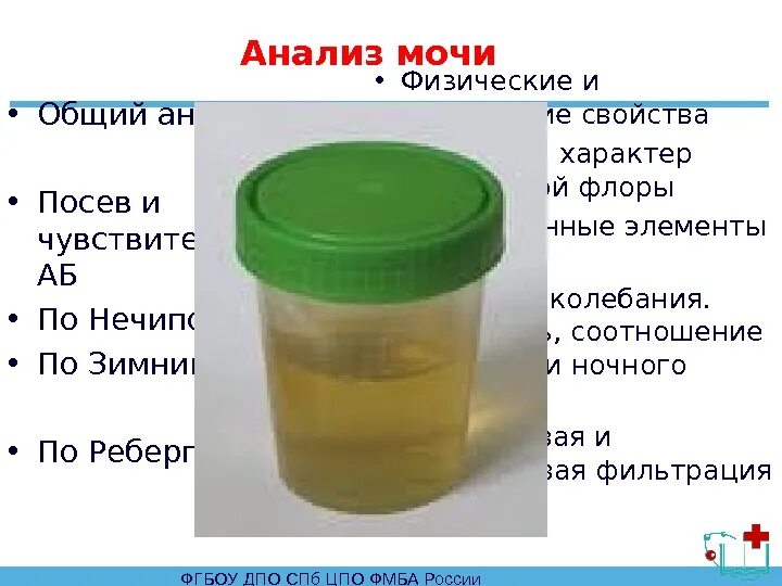 Как сдавать мочу на анализ мужчине. Анализ мочи. Сколько мочи надо для анализа. Анализ м. Сколько нужно мочи для анализа.