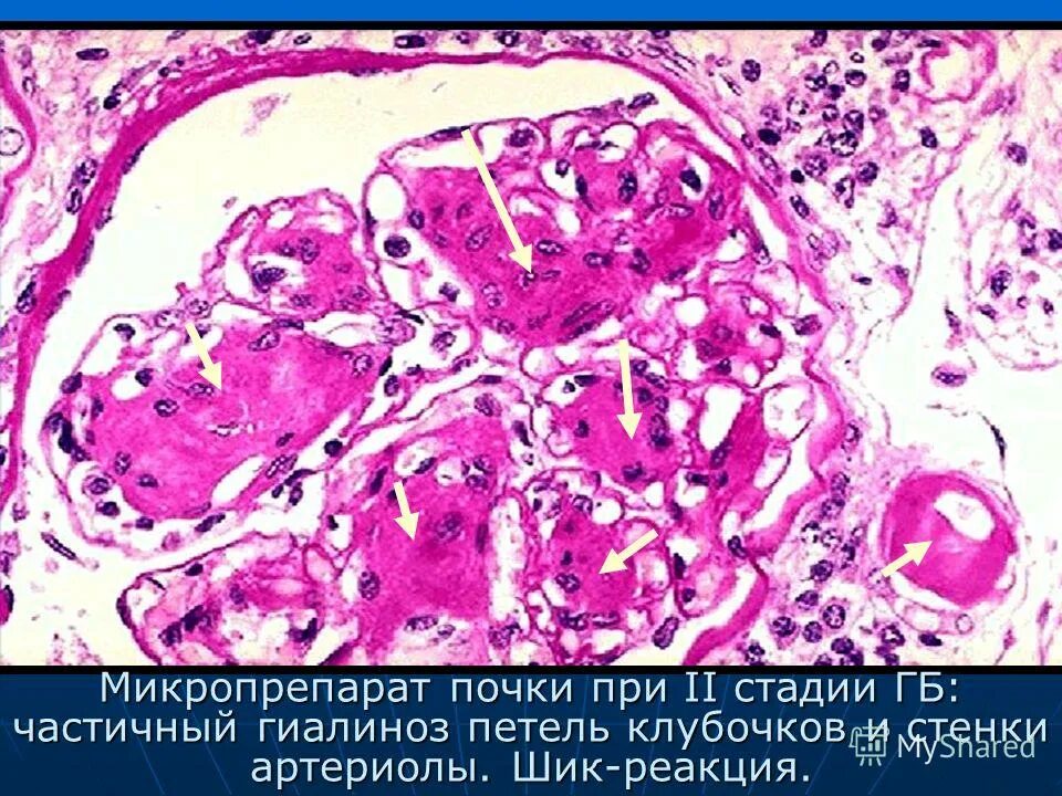 шик реакция