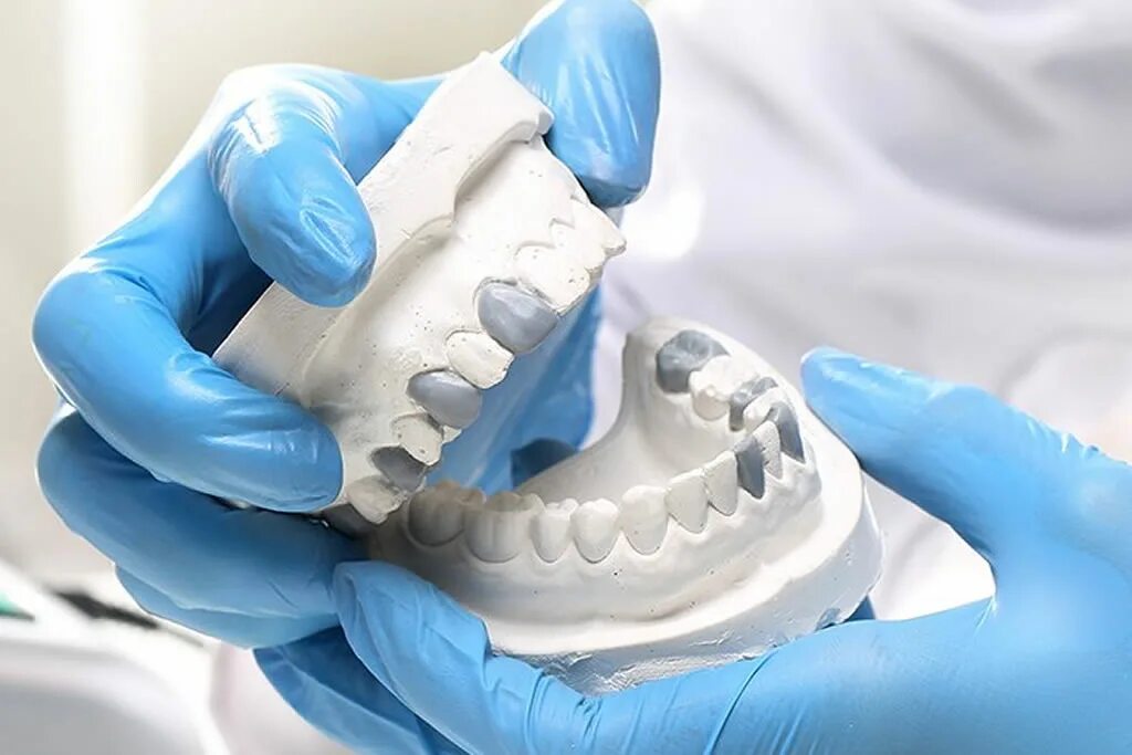 Стоматология протезирование. Протезирование зубов. Зубные протезы нового поколения. Зубопротезирование Китай. Работа протезиста