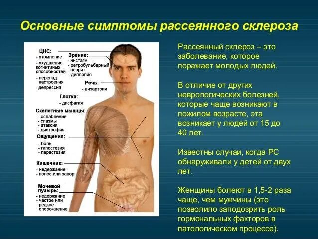 Первичные признаки мужчины. Рассеянный склероз симптомы у мужчин. Рассеянный склероз симпто. Россенисклероз симптомы. Расеянныймсклероз симптомы.