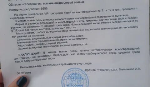 Узи голени мягких