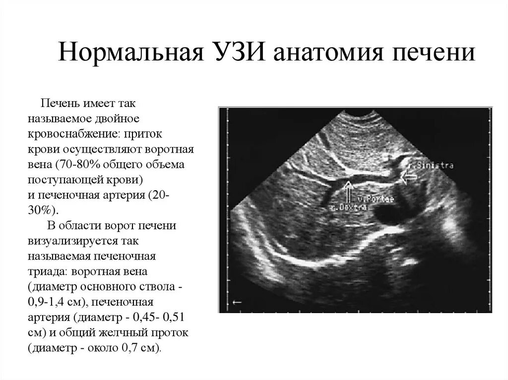 Ультразвуковое исследование печени. Нормальная печень.. Какие показатели УЗИ печени в норме. Показатели УЗИ печени норма. Ультразвуковое исследование печени норма. Показатели узи печени