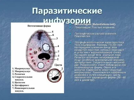 Почему инфузорию относят к простейшим