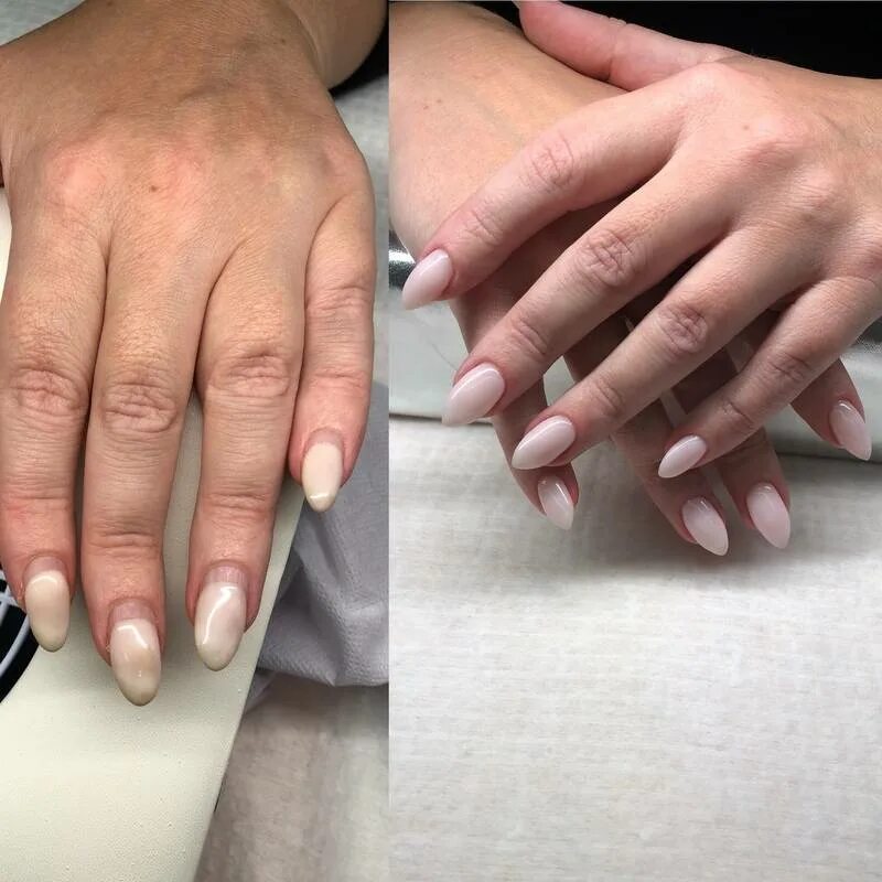 Коррекция ногтевой. Маникюр до и после. Наращивание ногтей. Коррекция ногтей до и после. Ногти до и после маникюра.