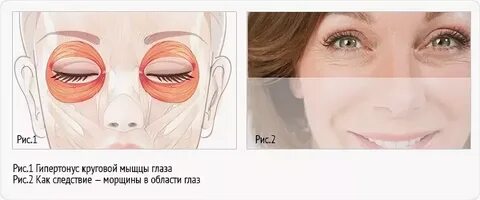 Ревитоника носогубные складки