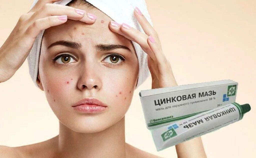 Можно ли использовать мазь для лица. Реклама крема от прыщей. мазь от прыщей. циндоловая мазь от прыщей. цинковая мазь от прыщей на лице.