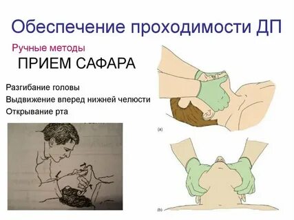 Тройной прием сафара