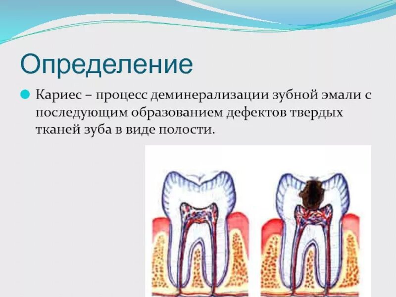 Сообщающаяся с полостью зуба