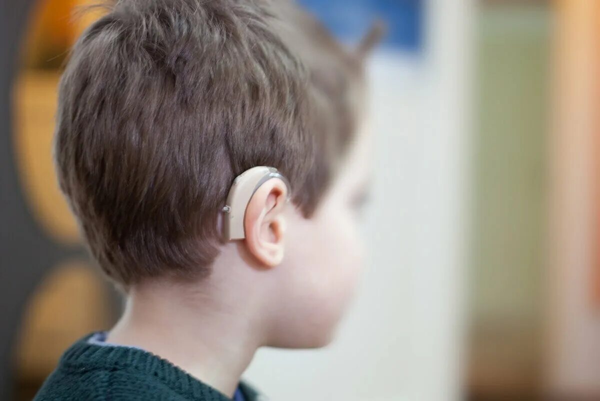 Слуховой аппарат для слабослышащих. Аппарат для глухих кохлеарная имплантация. Аппарат Cochlear кохлеарный. Слуховой аппарат Cochlear 8. Кохлеарный имплант Кохлер.