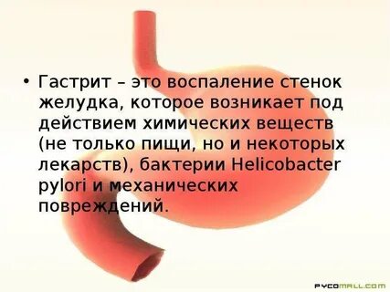 Гастрит презентация