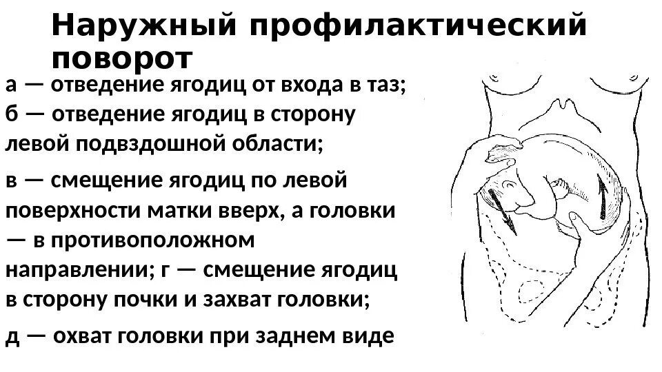 Положение плода продольное головное. Операции исправляющие положение плода. Различные положения плода в матке. Физиологическое положение плода.