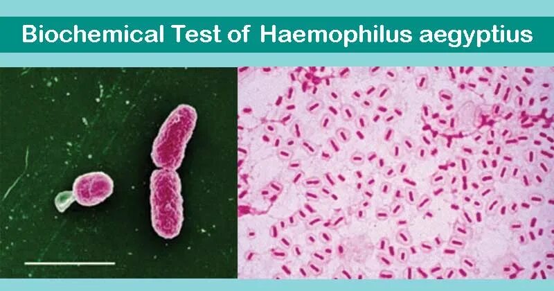 Палочка Пфейффера. Гемофильная палочка оксидаза. Haemophilus influenzae 10