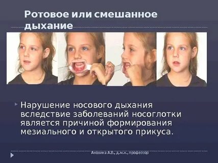 Отличия d от c