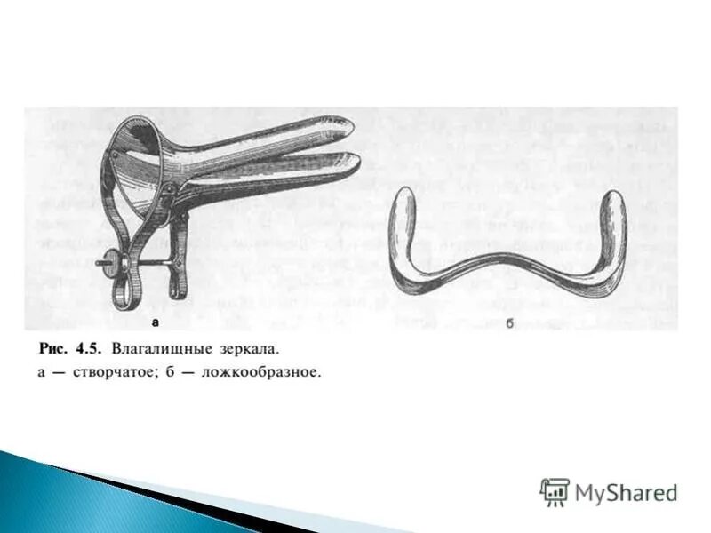 гинекологический осмотр зеркалом. исследование с помощью зеркал. гинекологическое зеркало схема. осмотр влагалища и шейки матки. исследование в зеркалах куско.