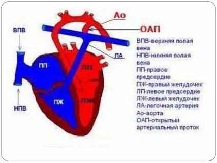Открытая легочная артерия