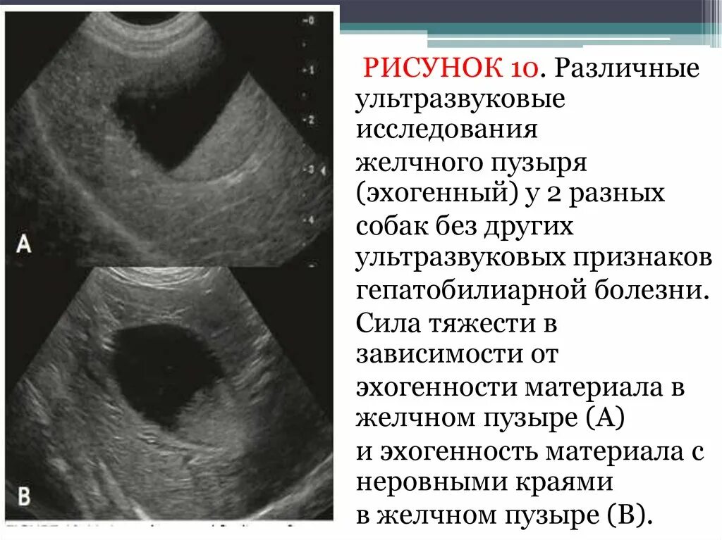 Эхогенный желчный пузырь. Анэхогенные структуры желчного пузыря. Гиперэхогенные желчном пузыре. УЗИ желчного пузыря. УЗИ желчного пузыря у собаки.