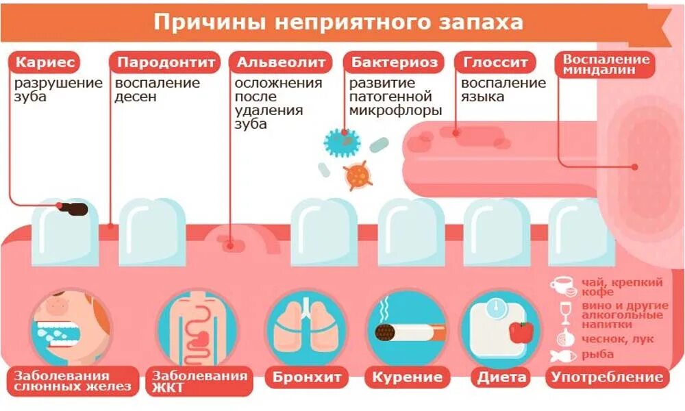 Запах изза РТВ причинф. Неприятный запах изо рта причины. Причтнв запаха изо РТП.