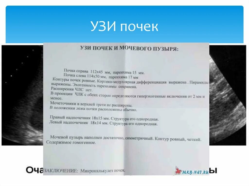 Ультразвуковое исследование мочевого пузыря у детей норма. Ультразвуковое исследование органов мочевой системы. УЗИ почек. УЗИ почек и мочевого пузыря. Узи почек на голодный