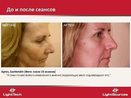 Сеанс после