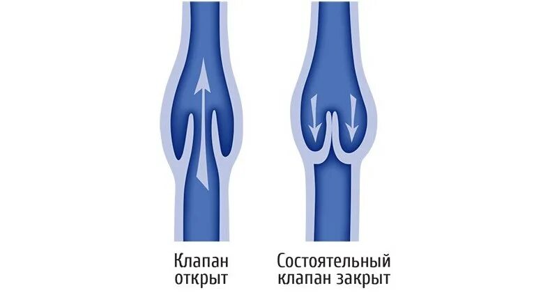 Вены ног клапаны