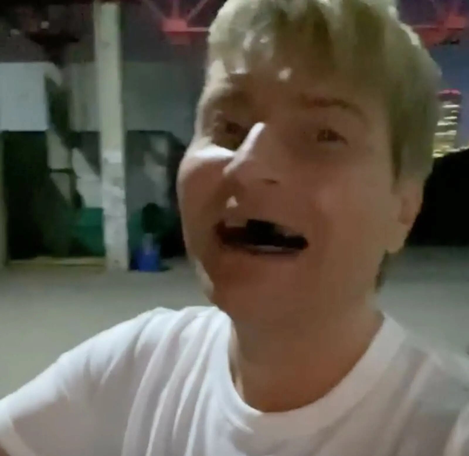 Зубы блоггеров