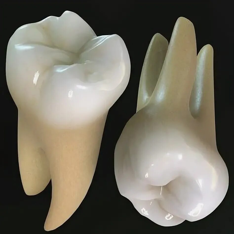 Molar (tooth) - Wikipedia