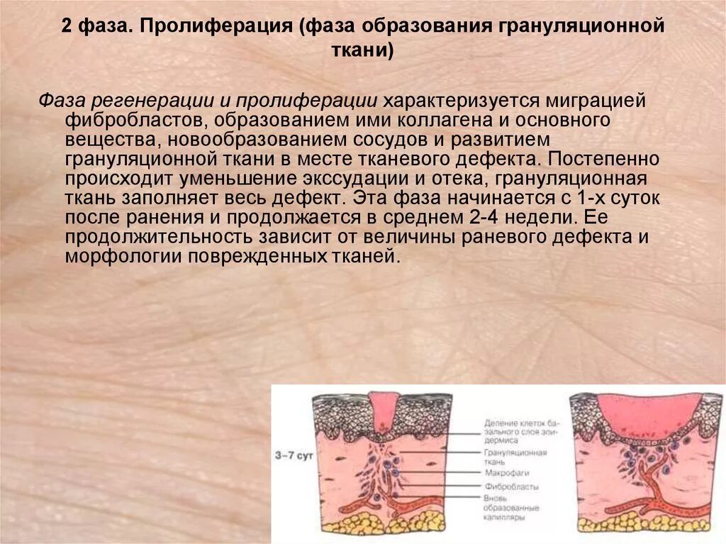 Грануляция тканей - Арт Минск.ру