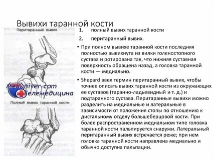 Растяжение кости