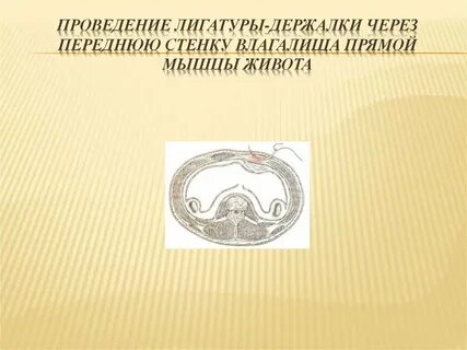 Через переднюю