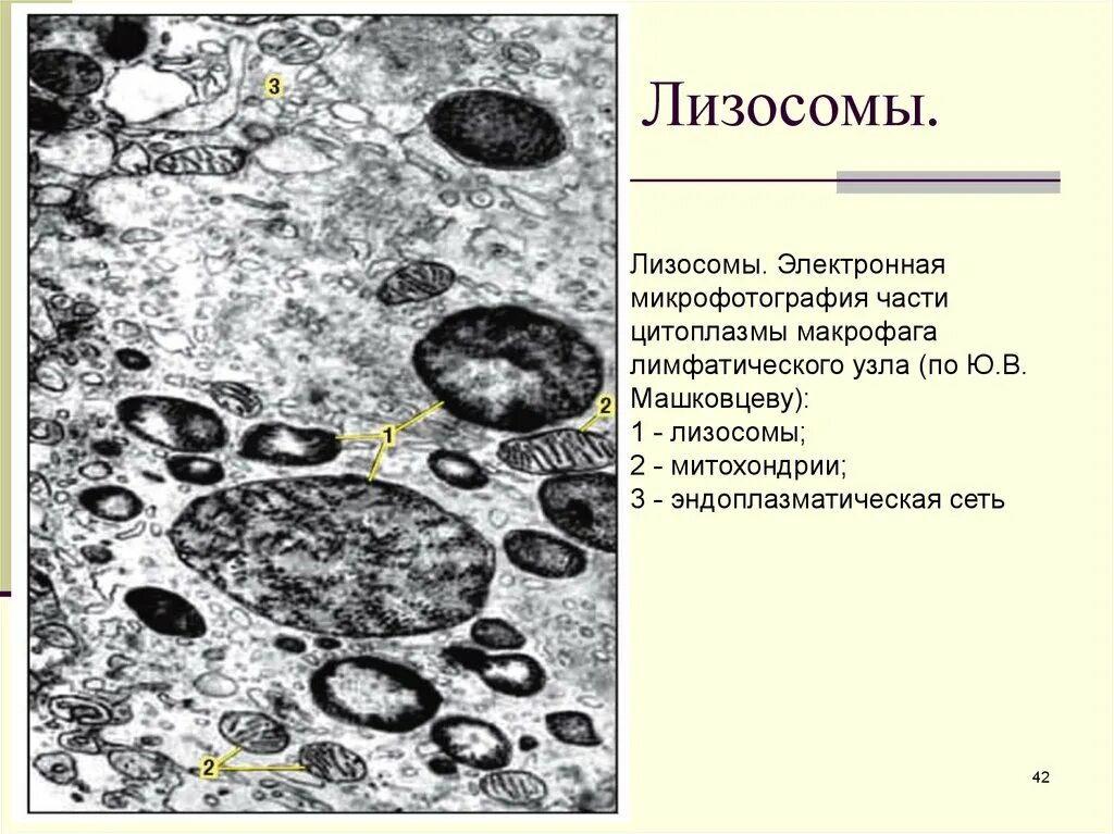 Лизосома электронная микрофотография. Лизосома электронная микрофотография. Лизосома электронная микрофотография. Электронограмма лизосом. Лизосомы электронная микроскопия.