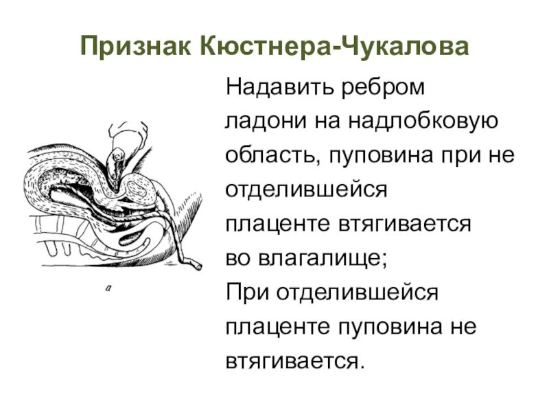 Признак отделения плаценты кюстнера чукалова. Признак отделения плаценты кюстнера чукалова. Признак отделения последа кюстнера-чукалова. Признаки отделения плаценты кюстнера-чукалова. Признак альфельда отделения плаценты.