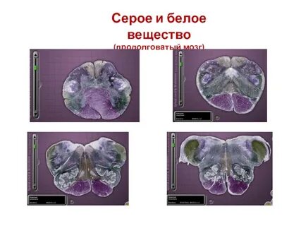 Белое вещество продолговатого мозга