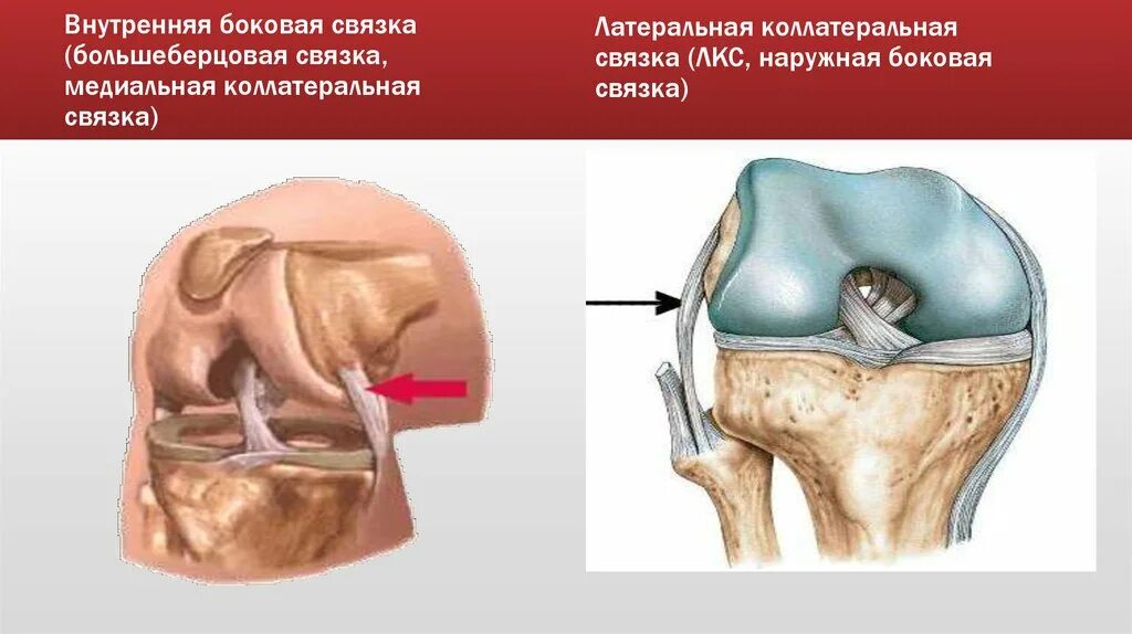 Внутренняя боковая связка. Внутренняя боковая коллатеральная связка. Поперечная связка. Капсула связочный аппарат.