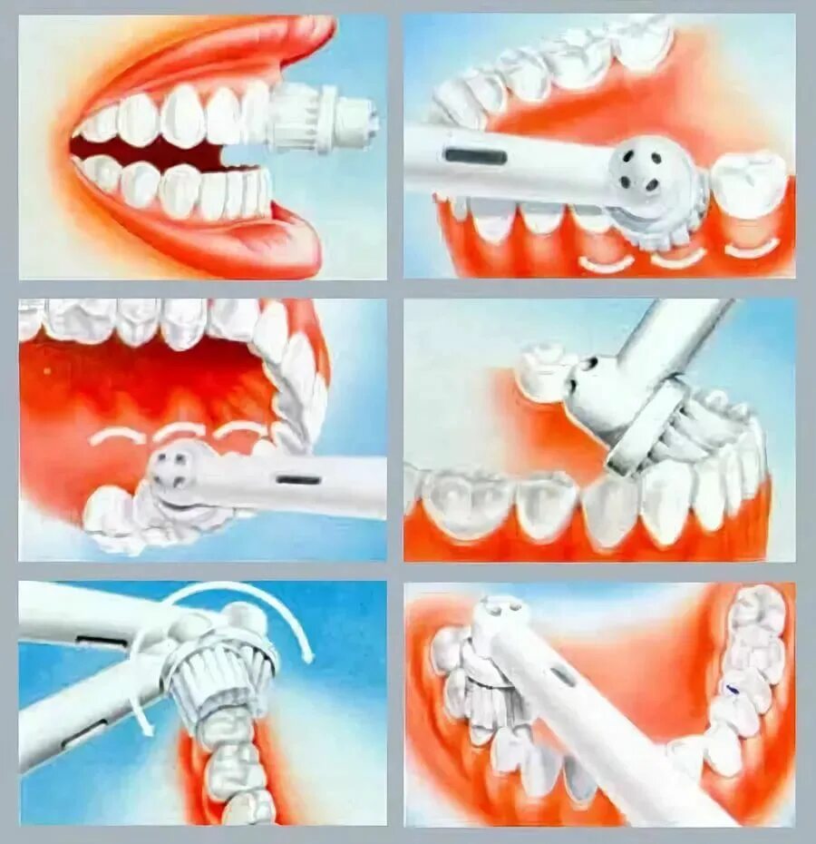 Техника чистки зубов. Правильная техника чистки зубов электрической щеткой. Правильная чистка зубов. Правильная методика чистки зубов электрической щеткой. Что кушать после чистки зубов