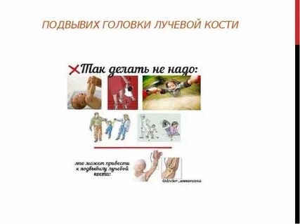Вывих лучевой кости