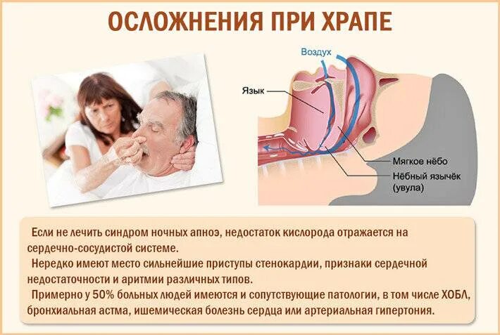 Почему младенец храпит. Почему младенец храпит