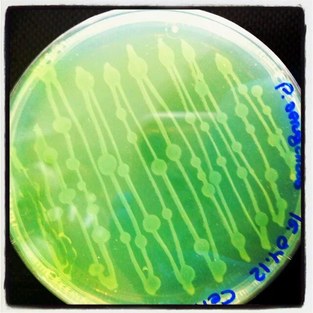 Pseudomonas Fluorescens колония. Синегнойная палочка на агаре. Pseudomonas aeruginosa на цетримидном агаре. Pseudomonas aeruginosa микробиология.