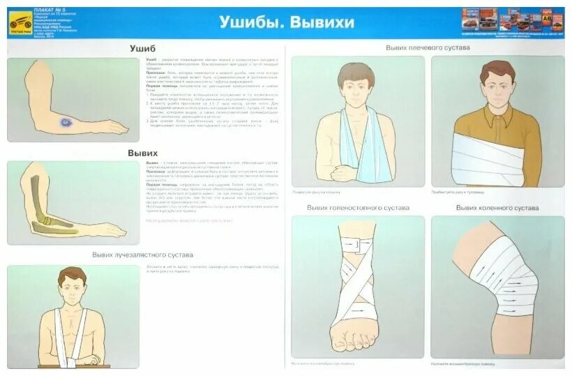 Ушибы при дтп