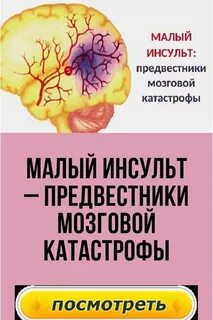 Маленький инсульт