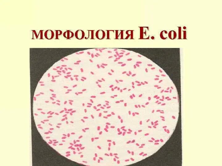 Эшерихия микробиология. Грамм положительные и грамм отрицательные микроорганизмы. Представители энтеробактерий окрашиваются по грамму. Escherichia coli окраска фуксином. Эшерихия коли микроскопия.
